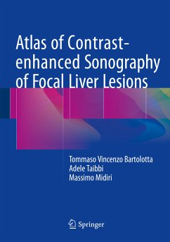 Atlas of Contrast-enhanced Sonography of Focal Liver Lesions (eBook, PDF) - Bartolotta, Tommaso Vincenzo; Taibbi, Adele; Midiri, Massimo