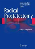 Radical Prostatectomy (eBook, PDF)