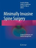 Minimally Invasive Spine Surgery (eBook, PDF)