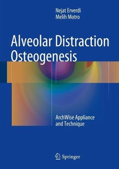 Cover Alveolar Distraction Osteogenesis (eBook, PDF)
