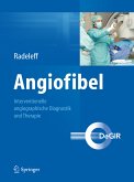 Angiofibel (eBook, PDF)