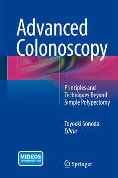 Advanced Colonoscopy (eBook, PDF)