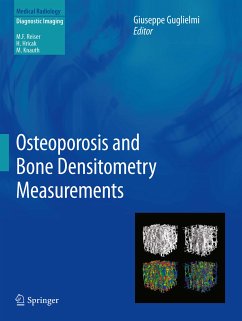 Osteoporosis and Bone Densitometry Measurements (eBook, PDF)