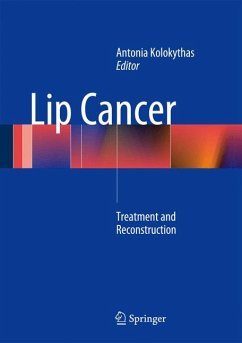 Lip Cancer (eBook, PDF)