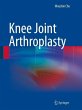 Knee Joint Arthroplasty (eBook, PDF) - Bild 1