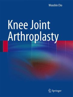 Knee Joint Arthroplasty (eBook, PDF) - Cho, Wooshin