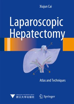 Laparoscopic Hepatectomy (eBook, PDF) - Cai, Xiujun