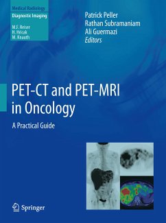 PET-CT and PET-MRI in Oncology (eBook, PDF)