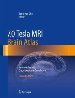 Cover 7.0 Tesla MRI Brain Atlas (eBook, PDF)