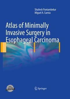 Atlas of Minimally Invasive Surgery in Esophageal Carcinoma (eBook, PDF)