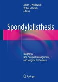 Spondylolisthesis (eBook, PDF) Spondylolisthesis (eBook, PDF)