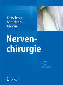 Nervenchirurgie (eBook, PDF)
