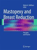 Mastopexy and Breast Reduction (eBook, PDF)
