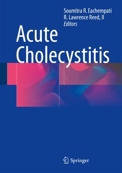 Acute Cholecystitis (eBook, PDF)