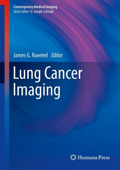 Lung Cancer Imaging (eBook, PDF)