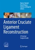 Anterior Cruciate Ligament Reconstruction (eBook, PDF)