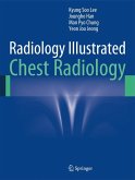 Radiology Illustrated: Chest Radiology (eBook, PDF)