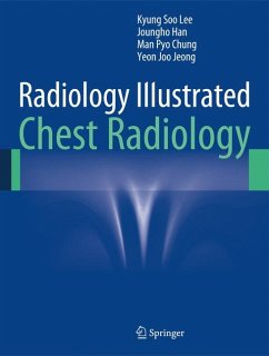 Radiology Illustrated: Chest Radiology (eBook, PDF) - Lee, Kyung Soo; Han, Joungho; Chung, Man Pyo; Jeong, Yeon Joo