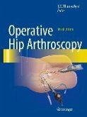 Operative Hip Arthroscopy (eBook, PDF)