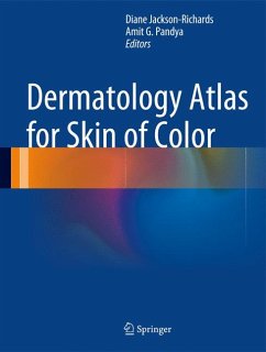 Dermatology Atlas for Skin of Color (eBook, PDF)