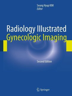 Radiology Illustrated: Gynecologic Imaging (eBook, PDF)