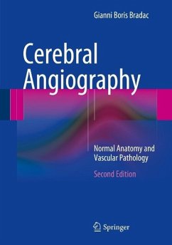 Cerebral Angiography (eBook, PDF) - Bradac, Gianni Boris