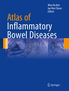 Atlas of Inflammatory Bowel Diseases (eBook, PDF)