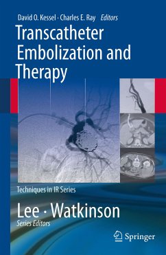 Transcatheter Embolization and Therapy (eBook, PDF)