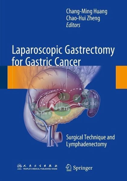 Laparoscopic Gastrectomy for Gastric Cancer (eBook, PDF) Laparoscopic Gastrectomy for Gastric Cancer (eBook, PDF)