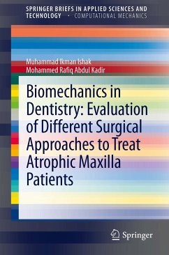 Biomechanics in Dentistry: Evaluation of Different Surgical Approaches to Treat Atrophic Maxilla Patients (eBook, PDF) - Ishak, Muhammad Ikman; Abdul Kadir, Mohammed Rafiq