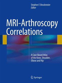 MRI-Arthroscopy Correlations (eBook, PDF)
