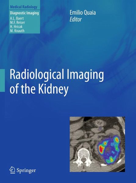Radiological Imaging of the Kidney (eBook, PDF) Radiological Imaging of the Kidney (eBook, PDF)