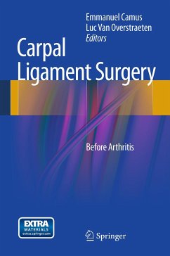 Carpal Ligament Surgery (eBook, PDF)