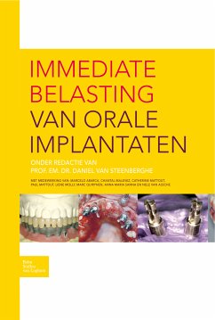 Immediate belasting van orale implantaten (eBook, PDF) - Steenberghe, D.