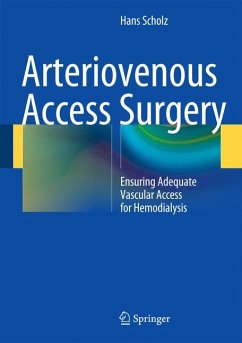 Arteriovenous Access Surgery (eBook, PDF) - Scholz, Hans