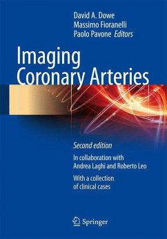 Imaging Coronary Arteries (eBook, PDF)
