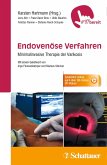 Endovenöse Verfahren (eBook, PDF)