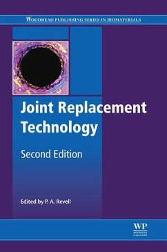 Joint Replacement Technology (eBook, ePUB)