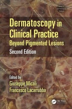 Dermatoscopy in Clinical Practice