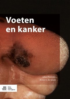 Voeten En Kanker - Toonstra, Johan; de Groot, Anton C