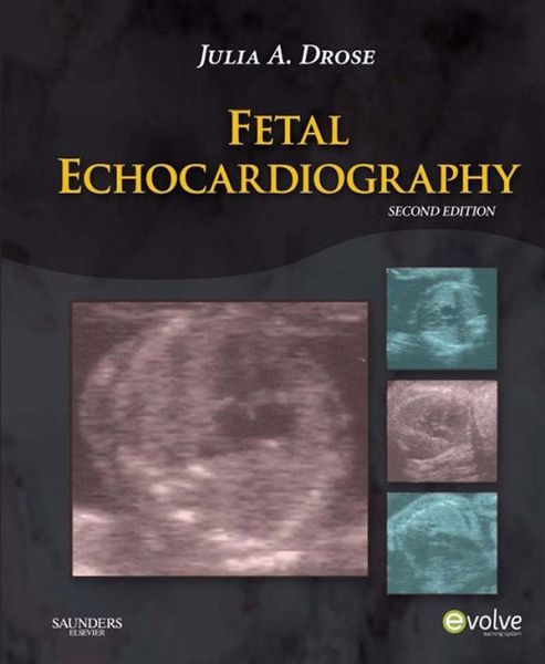 Fetal Echocardiography - E-Book (eBook, ePUB)