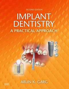 Implant Dentistry - E-Book (eBook, ePUB) - Garg, Arun K.