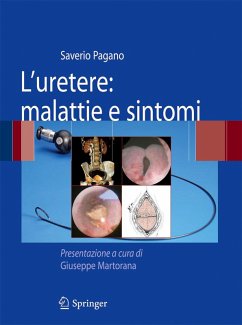 Cover L'uretere: malattie e sintomi (eBook, PDF)
