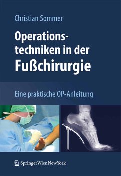 Operationstechniken in der Fußchirurgie (eBook, PDF) - Sommer, Christian