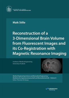 Reconstruction of a 3-Dimensional Brain Volume from Fluorescent Images and its Co-Registration with Magnetic Resonance Imaging