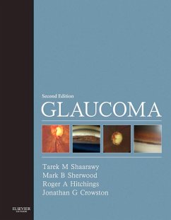 Glaucoma E-Book (eBook, ePUB) - Shaarawy, Tarek M.; Sherwood, Mark B.; Hitchings, Roger A.; Crowston, Jonathan G.