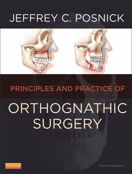Orthognathic Surgery (eBook, ePUB) Orthognathic Surgery (eBook, ePUB)