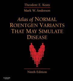 Atlas of Normal Roentgen Variants That May Simulate Disease E-Book (eBook, ePUB) - Keats, Theodore E.; Anderson, Mark W.