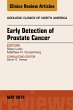Early Detection of Prostate Cancer, An... - Bild 1