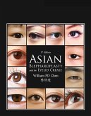 Asian Blepharoplasty and the Eyelid Crease E-Book (eBook, ePUB)